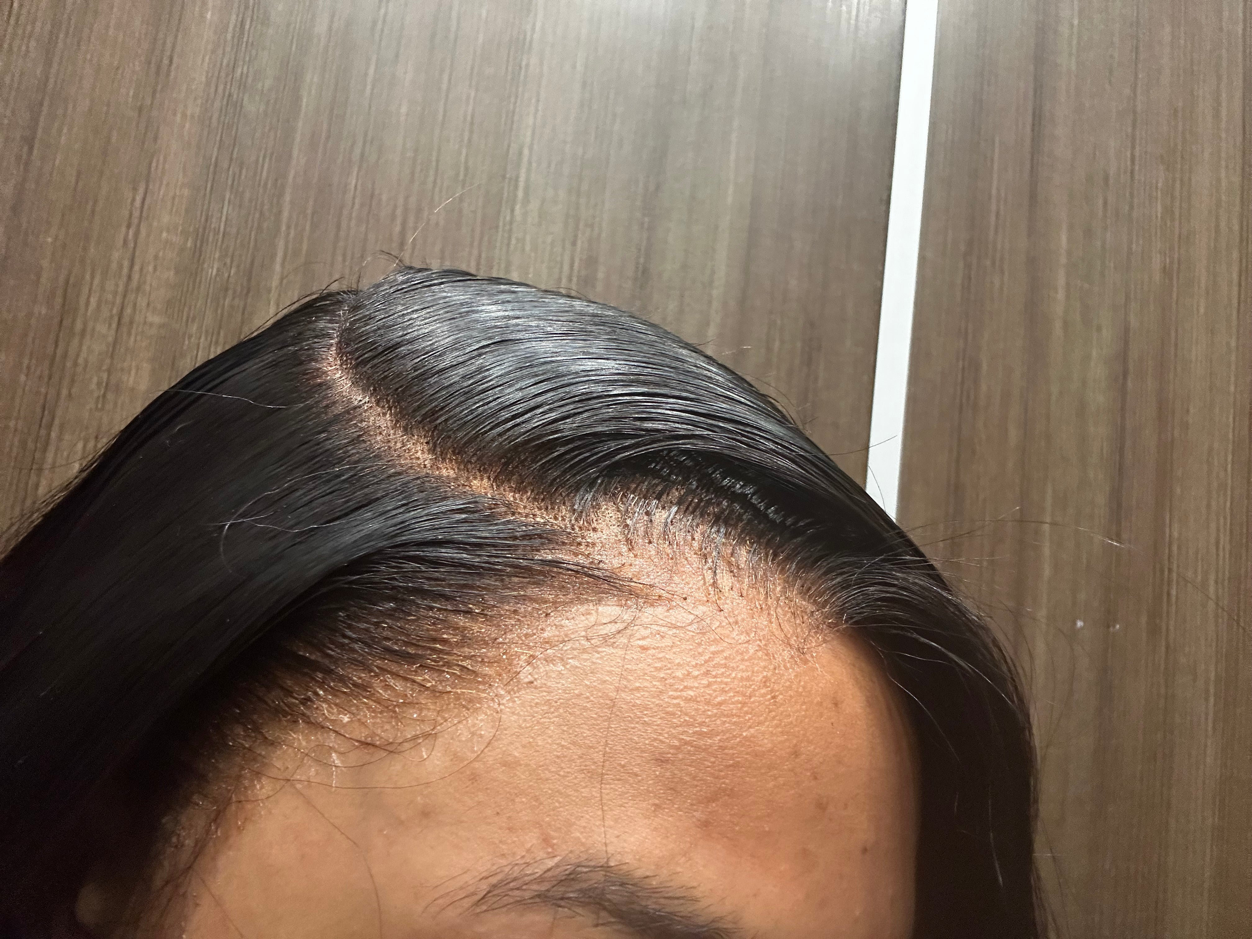 HD Lace Closure